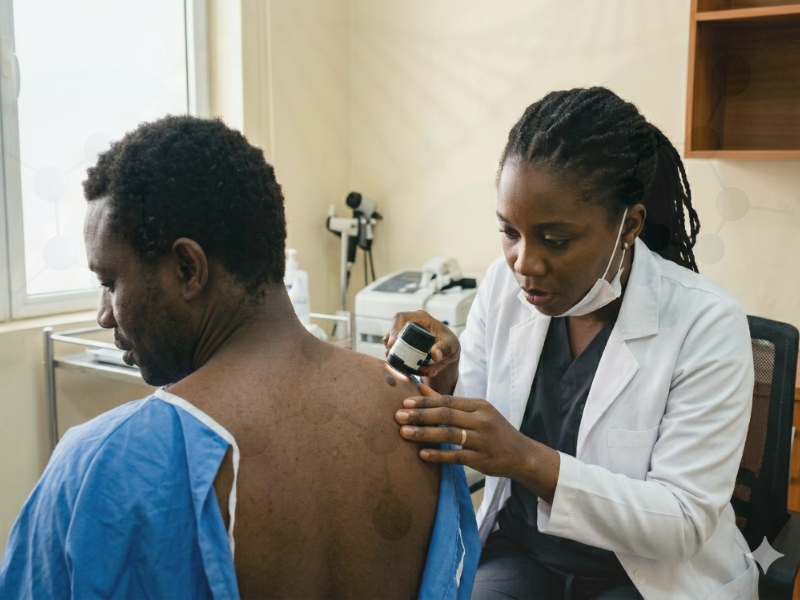 A clinical photograph taken in Nigeria showing a dermatologist examining a patient's palm, juxtaposed with an integrated DNA graphic, illustrating the connection between personal screening and genetics for Melanoma in Nigeria.